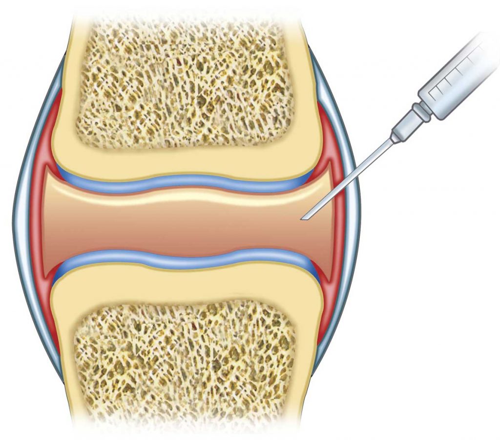 Radiologische Therapie Radiologie.de